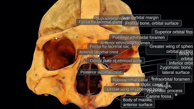 Orbit of human skull and meninges