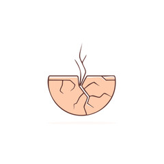 Dry Cracked Skin with Irregular Fissures and Flaking Epidermis Illustration