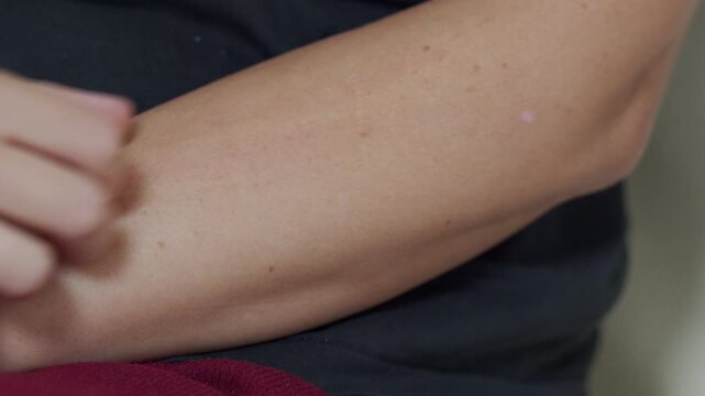 a woman scratching her arm, highlighting the action of scratching and the relief of an itch.