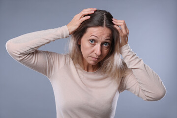 Worried woman with hair loss problem on grey background
