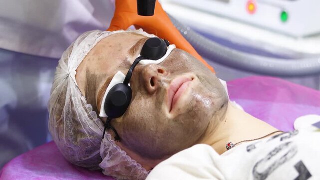 Cosmetologist Performing Carbon Laser Peel on Woman's Face. Full View of Procedure