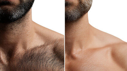 PNG of Close-up of a male's neck and chest area, showcasing different grooming styles with hair and skin texture differences.