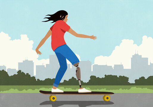 Girl with prosthetic leg skateboarding on sidewalk in city park
