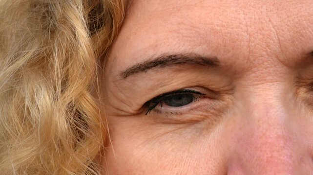 middle aged female's eye with drooping eyelid with patch for eyes. Ptosis is a drooping of the upper eyelid, lazy eye. Cosmetology and facial concept, first wrinkles,