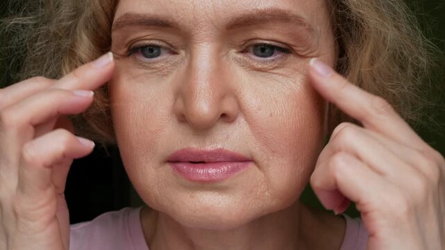 middle aged female's eye with drooping eyelid with patch for eyes. Ptosis is a drooping of the upper eyelid, lazy eye. Cosmetology and facial concept, first wrinkles