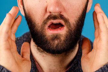 Close-up of a bearded man with an open mouth, hands near face, expressing shock or surprise. Great...