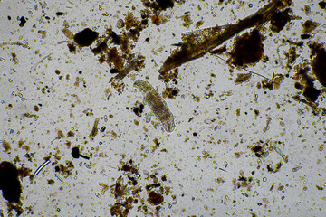 Tardigrade and soil fungal hyphae fungi microorganisms in a soil sample on a farm