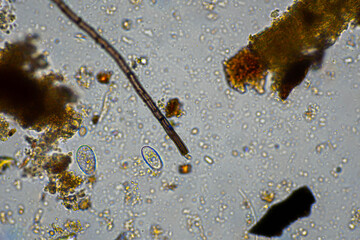Tardigrade and soil fungal hyphae fungi microorganisms in a soil sample on a farm