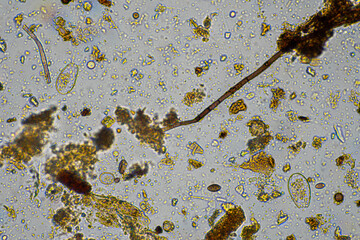 tardigrade soil microorganisms including nematode, and rotifers a soil sample, soil fungus and bacteria on a regenerative farm in compost under the microscope.