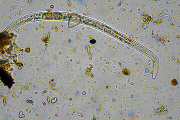 tardigrade soil microorganisms including nematode, and rotifers a soil sample, soil fungus and bacteria on a regenerative farm in compost under the microscope.