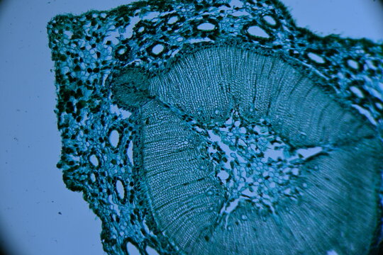 Zdjęcie mikroskopowe. Kom&oacute;rki roślinne. Łodyga sosny przekr&oacute;j poprzeczny. Powiększenie 40x.