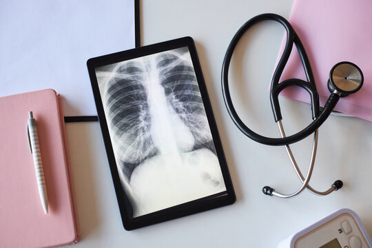 Digital tablet displaying chest X-ray image showing lungs on medical desk surrounded by stethoscope, clipboard, pen and documents, representing cancer diagnosis and healthcare