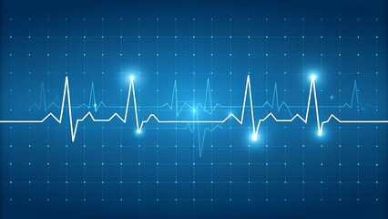 Heartbeat line on blue background with grid pattern