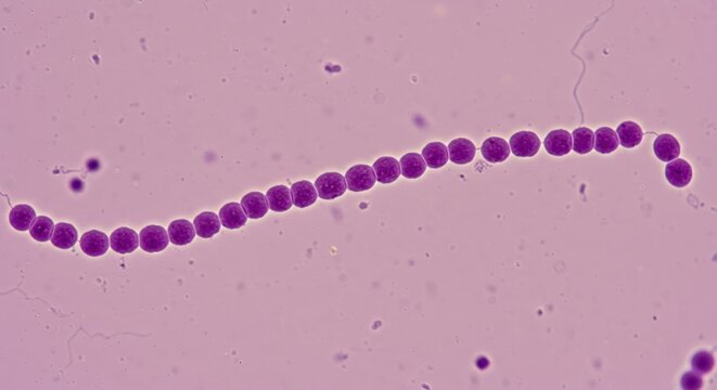 Detailed View of Streptococcus Chains A Key Diagnostic Tool for Disease Identification


