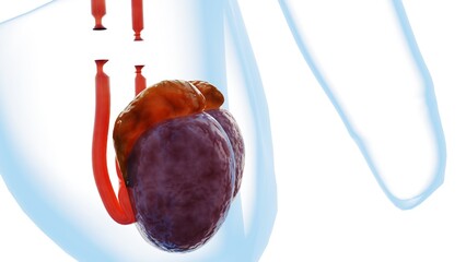 A 3d image vividly illustrates the outcome of a vasectomy. It shows two testes with their epididymis, each connected to a vas deferens that has been clearly cut and severed. permanent contraception