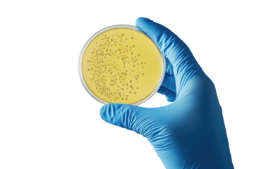 Hand in glove holding petri dish with bacterial colonies, black background