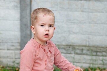 Young child with a concerned expression after playing outside in a backyard on a cool day