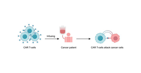 CAR T-cell therapy, killing of tumor cells. Cancer therapy. Chimeric antigen receptor T cell ,CAR T cell, for use in immunotherapy. Genetic engineering. Chemotherapy. Vector illustration.