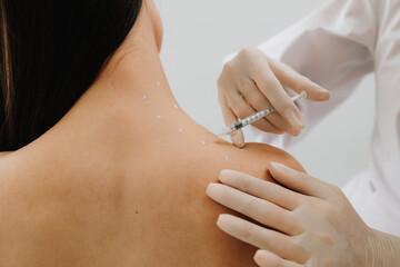 Preparation skin marking for migraine therapy. Remedy of headache problem and pain problems. Injection in marked dotes on back for migraine treatment by doctor.