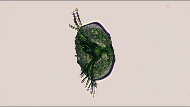 Light Microscopy of Ciliate Protist Trachelius With Food Vacuoles and Moving Oral Cilia in Slow Motion