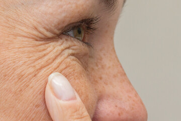 Smiling mature woman touching skin around eye, showing aging signs