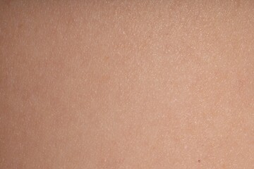 Macro view of normal skin as background