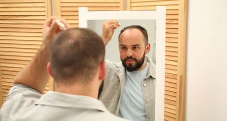Baldness treatment. Man applying serum onto his hair near mirror at home