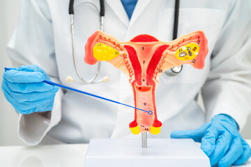 Doctor holding human uterus model for vaginal and cervix pap smear check up in the obstetrics and...