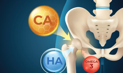 Hip Joint Supplement Absorption. Calcium, Hyaluronic Acid, Omega 3 Flow to Joint