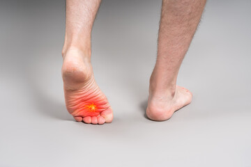 Foot pain, corns and calluses, dry skin on legs, man suffering from feet ache on gray background,...