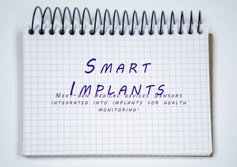 Smart Implants