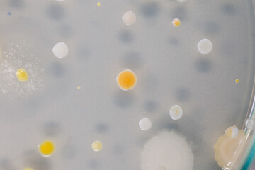 Backgrounds of Characteristics and Different shaped Colony of Bacteria growing on agar plates from Soil samples for education in Microbiology laboratory.