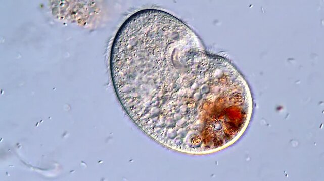 Protozoan Ciliates Captured in Clear Microscopic View, 400x magnification 
