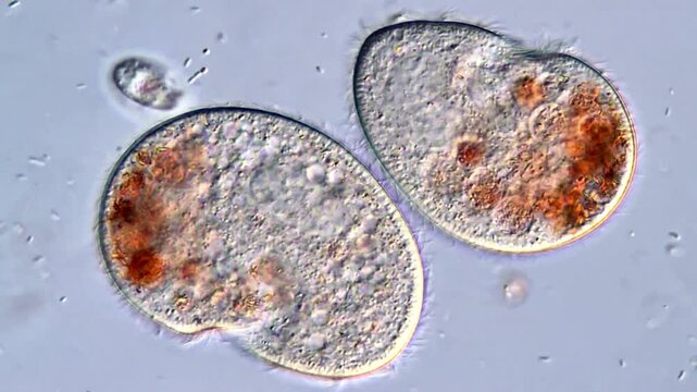 High-Detail Video of Protozoan Ciliates, microscope 400x 