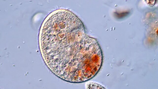 Micro Life Under Microscopy view &ndash; Ciliates in Action