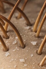 Dandruff on scalp macro
