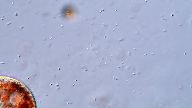 Protozoan Ciliates Floating Gracefully in Water, microscope view 400x 