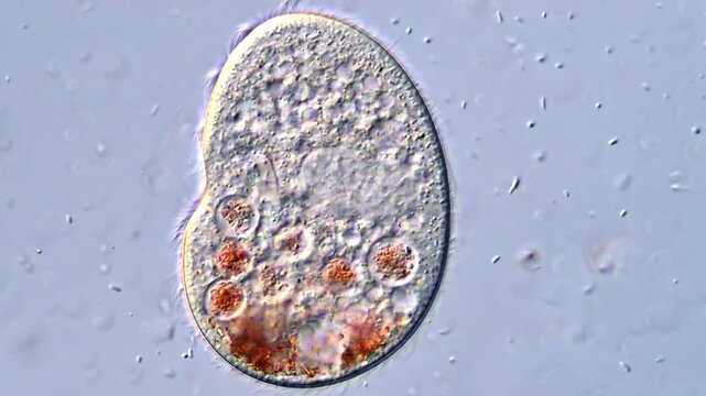 Ciliate Protozoa Feeding Under DIC Microscope 400x