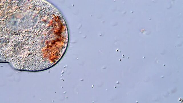 Microscopic View of Ciliates Movement in Water Sample, 400x