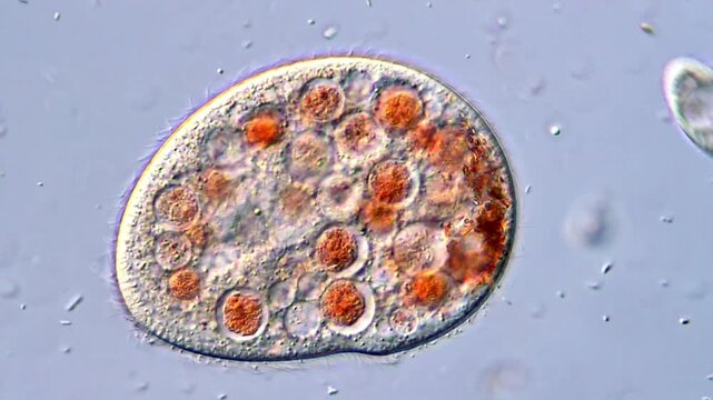 Ciliophora protozoa life, microscope view 400x magnification 