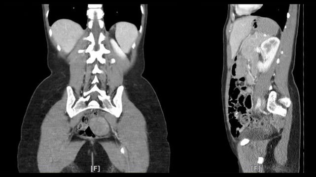x-ray scan of front body by mri ct scan Internal Organs and Liver,Lungs,Intestines,Stomach,Bladder,Kidneys.	
