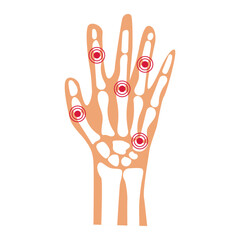Hand Joint Pain Anatomy Illustration