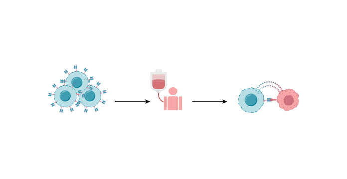 CAR T-cell therapy, killing of tumor cells. Cancer therapy. Chimeric antigen receptor T cell ,CAR T cell, for use in immunotherapy. Genetic engineering. Chemotherapy. Vector illustration.