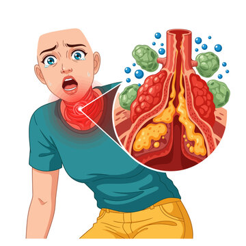 Worried woman experiencing severe throat pain with inflamed tonsils, depicting tonsillitis or strep throat, perfect for medical education materials