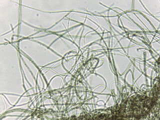 Microscopic filamentous structures in green