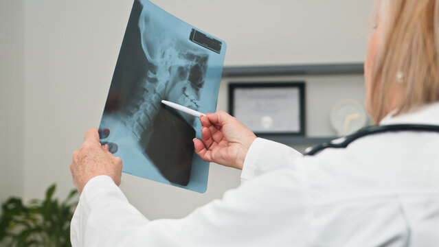 Doctor Points To Spine X-Ray For Diagnosis In Clinic, Hospital, And Medical Setting