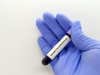 Obraz premium Doctor hold Blood sample for STD (Sexually Transmitted Disease) Test.