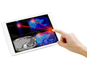 Hand interacting with tablet displaying PET/CT scans. Multiview diagnostic imaging highlights abnormal metabolic activity. Ideal for medical, oncology, and tech-related visuals.