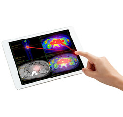 Hand interacting with tablet displaying PET/CT scans. Multiview diagnostic imaging highlights abnormal metabolic activity. Ideal for medical, oncology, and tech-related visuals.