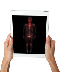 Hand interacting with tablet displaying PET/CT scans. Multiview diagnostic imaging highlights abnormal metabolic activity. Ideal for medical, oncology, and tech-related visuals.